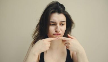 Skin Acting Up Lately