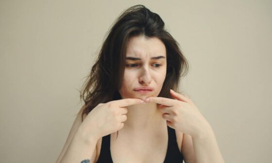 Skin Acting Up Lately