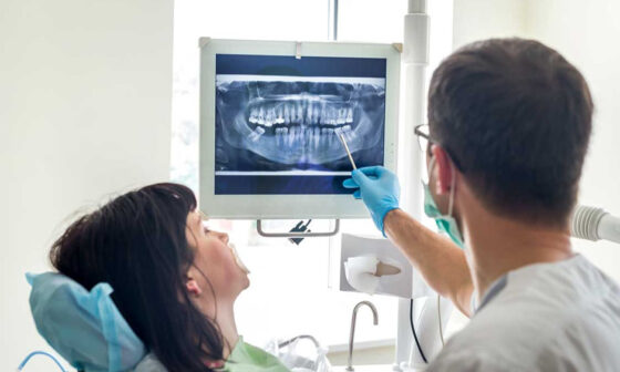General and Major Dental Cover