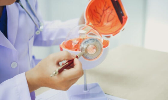 How Comprehensive Glaucoma Testing Supports Personalized Treatment Planning