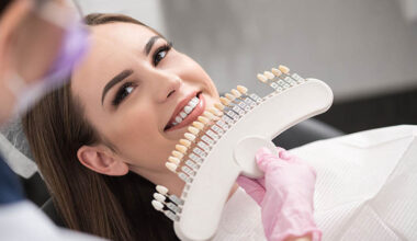 How to Maintain Your Results After Teeth Whitening in Maple Ridge