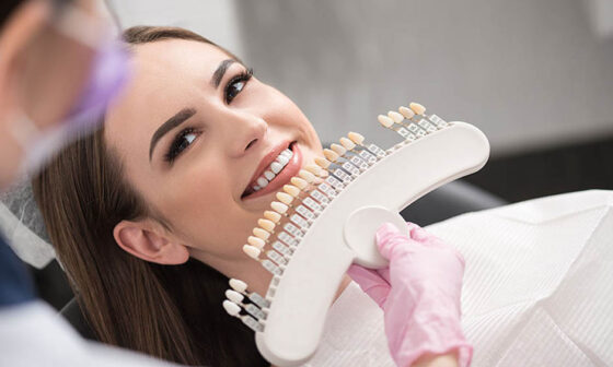 How to Maintain Your Results After Teeth Whitening in Maple Ridge