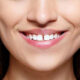 How to Repair Chipped or Gapped Teeth Without Major Surgery
