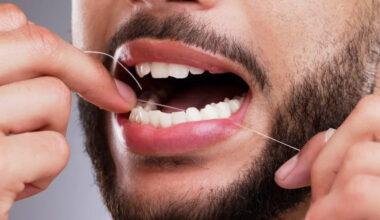 Floss