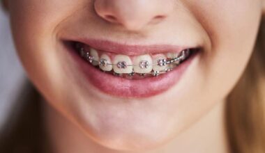 The Role of Orthodontists in Easing TMJ Discomfort in Chantilly