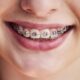 The Role of Orthodontists in Easing TMJ Discomfort in Chantilly