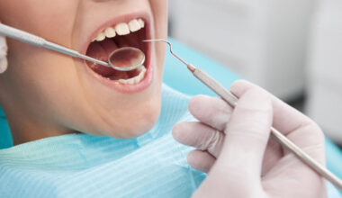 How to Choose the Right Dentist Without Overspending