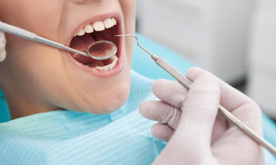 How to Choose the Right Dentist Without Overspending