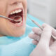 How to Choose the Right Dentist Without Overspending