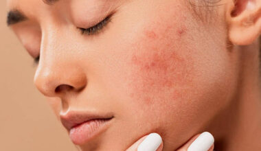 Skincare Sensitive Skin