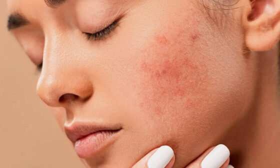 Skincare Sensitive Skin