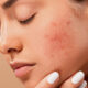 Skincare Sensitive Skin