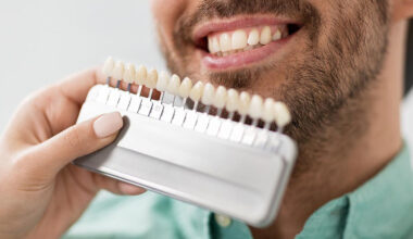 The Cost of Cosmetic Dentistry