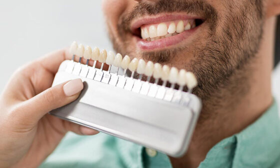 The Cost of Cosmetic Dentistry