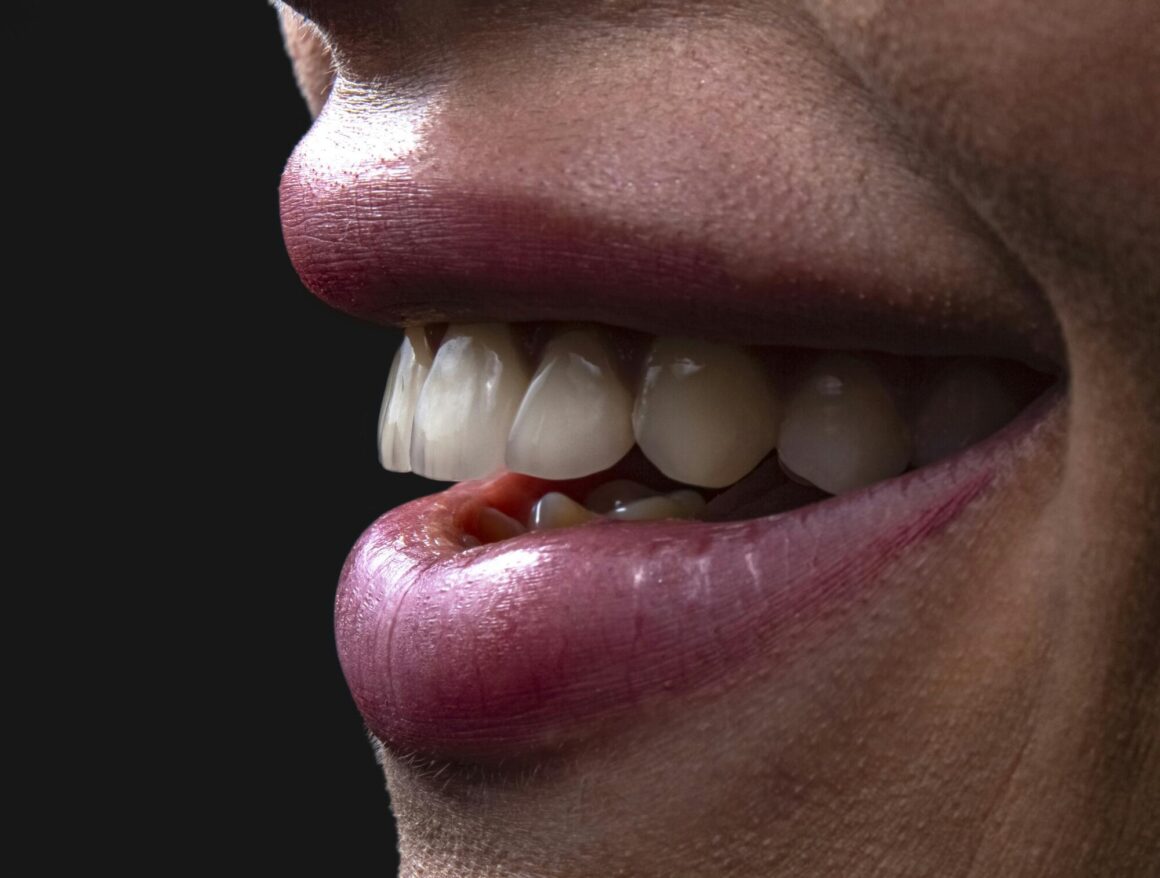 From Runway to Reality Smile Trends that Enhance Your Look