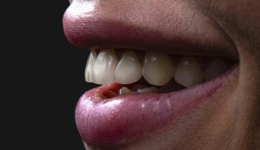 From Runway to Reality Smile Trends that Enhance Your Look