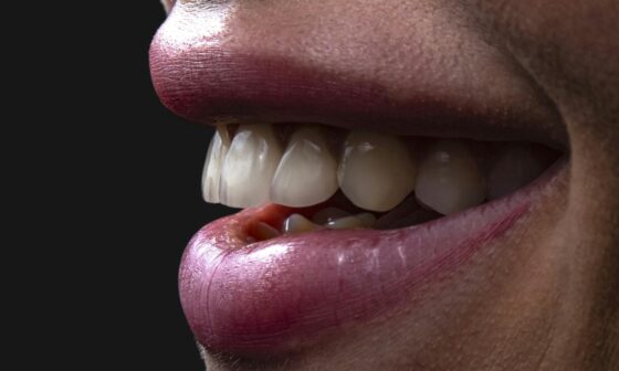 From Runway to Reality Smile Trends that Enhance Your Look