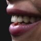 From Runway to Reality Smile Trends that Enhance Your Look