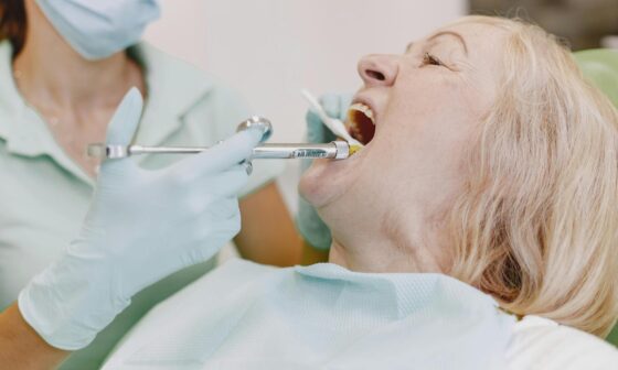 The Holistic Benefits of Implant Dentures for Overall Wellbeing