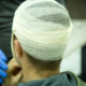 What Injured Workers Should Know About Brain Injury Claims in San Francisco