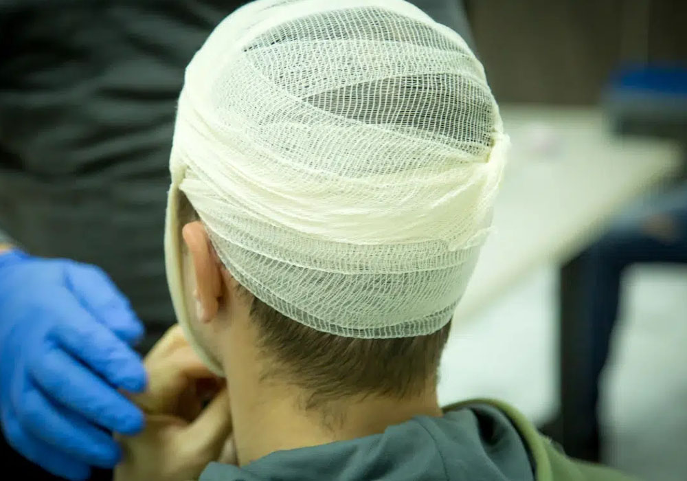 What Injured Workers Should Know About Brain Injury Claims in San Francisco